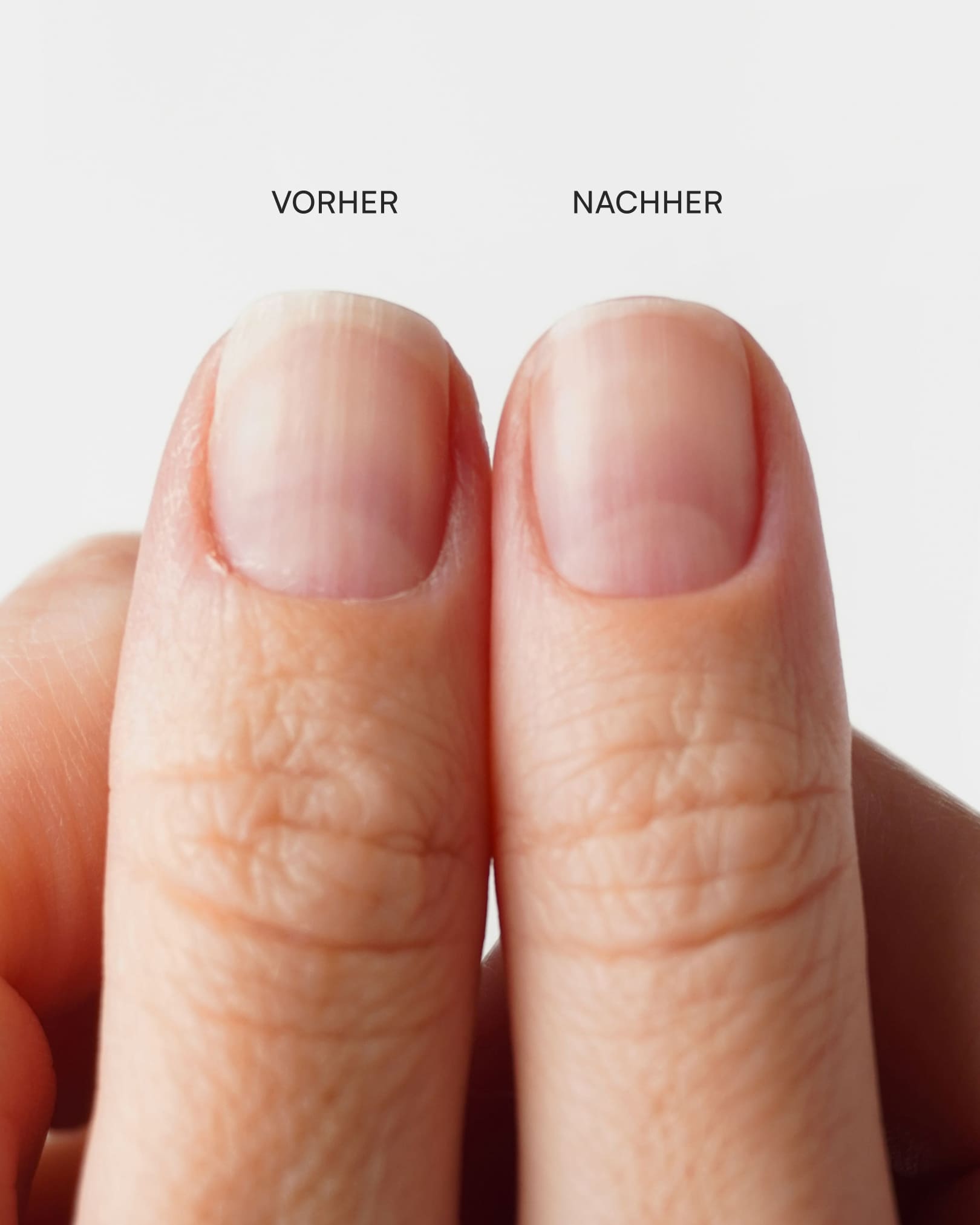 doonails-nagelhautzange-aus-edelstahl-pr-zision image 5