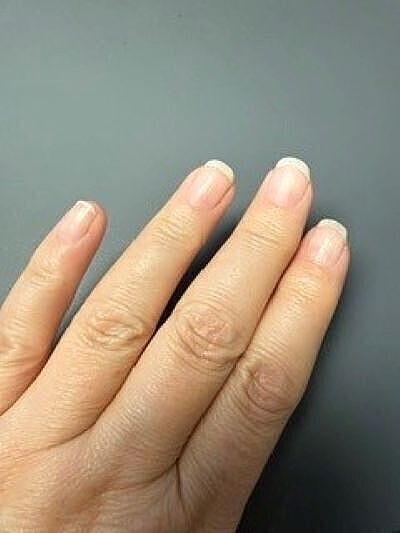 Meine Nägel sind gerettet