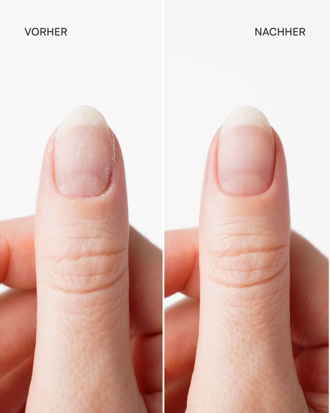 doonails-reinigungst-cher-nagelvorbereitung image 5