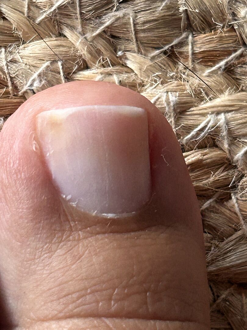 Mein Clean-Nails-Geheimnis