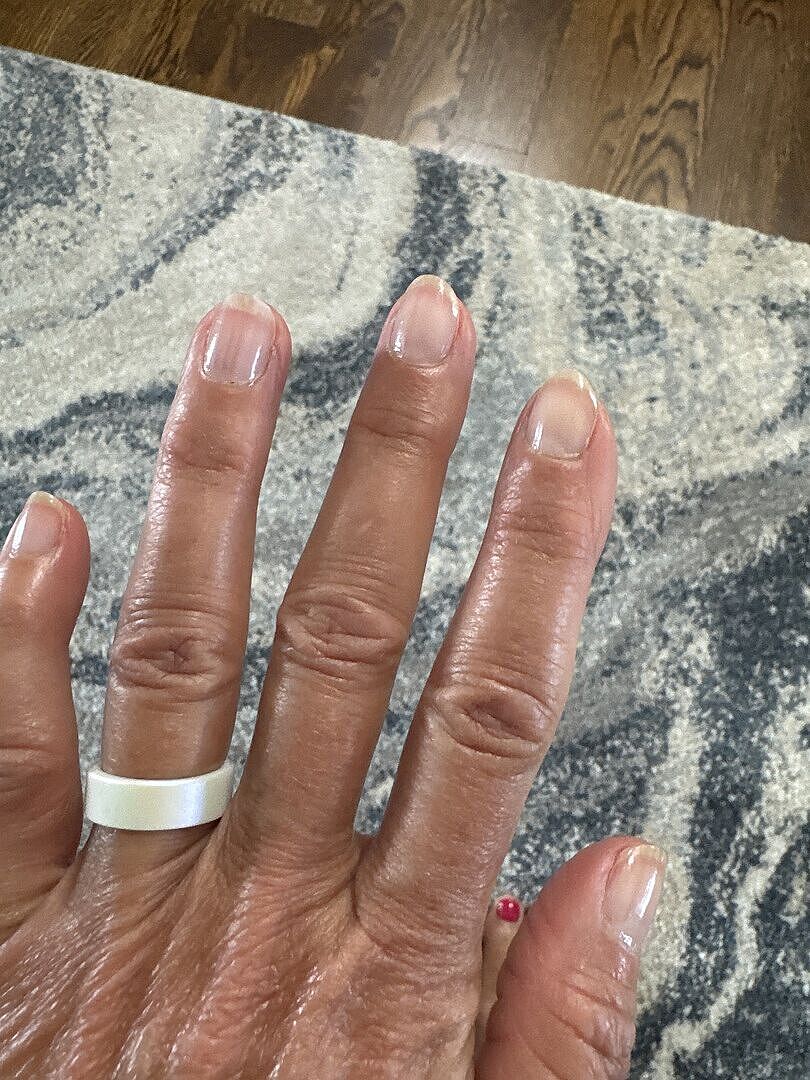 Perfekt nach Gel-Schaden