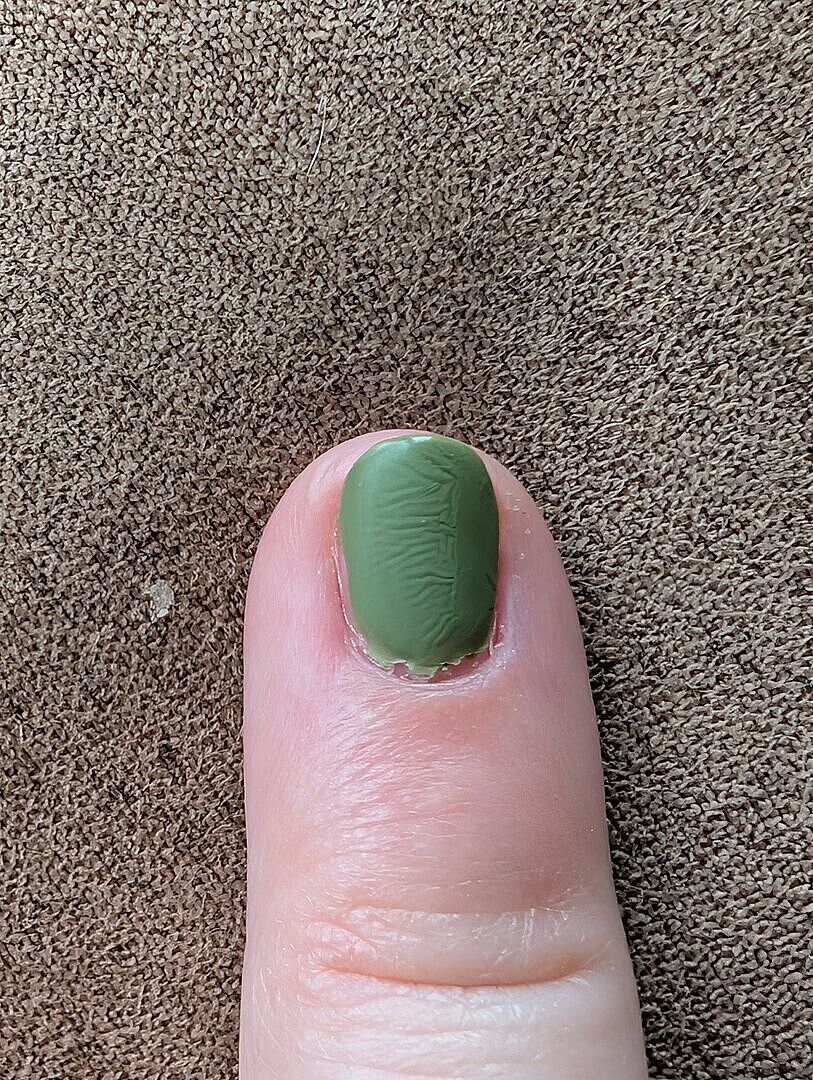 Mein drittes Fläschchen